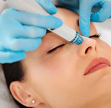 HydraFacial Syndeo Treatment in Irvine Orange County