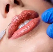 Juvederm, Restylane and Sculptra Dermal Fillers in Irvine CA