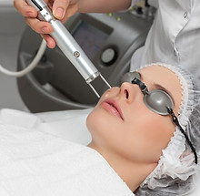 PicoWay Laser Treatment at Suncare Medical Clinic Irvine